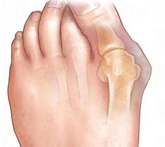 роздільник для пальців ніг силіконовий ортопедичний