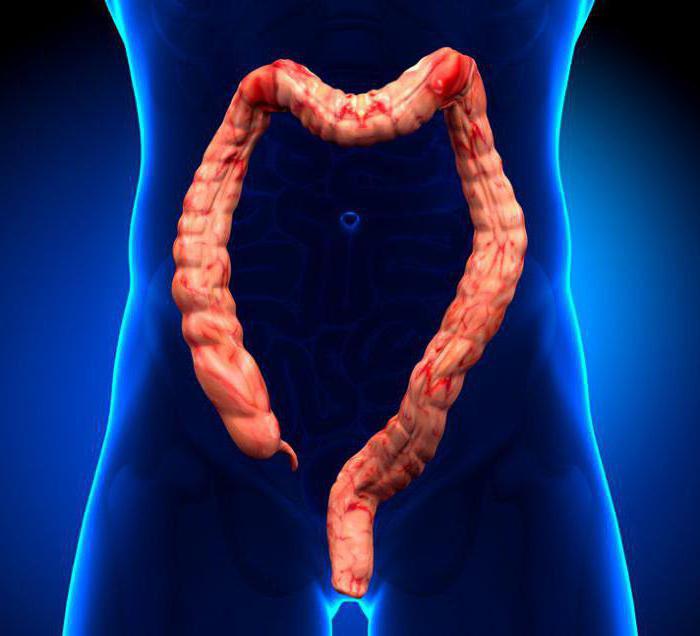 la dinámica de obstrucción intestinal