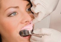 ) Después de la ortodoncia: ¿por qué se necesita y qué ventajas tienen?
