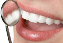 How much is to insert the teeth? Dental implants – an alternative way to regain the beauty of the smile