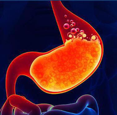 heartburn and belching causes and cures