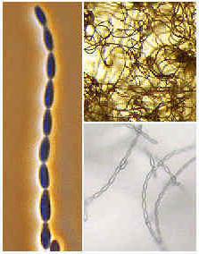 sexual reproduction of fungi