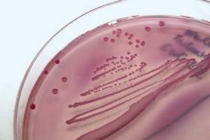 escherichia coli tedavisi