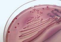 De onde Escherichia coli na urina?