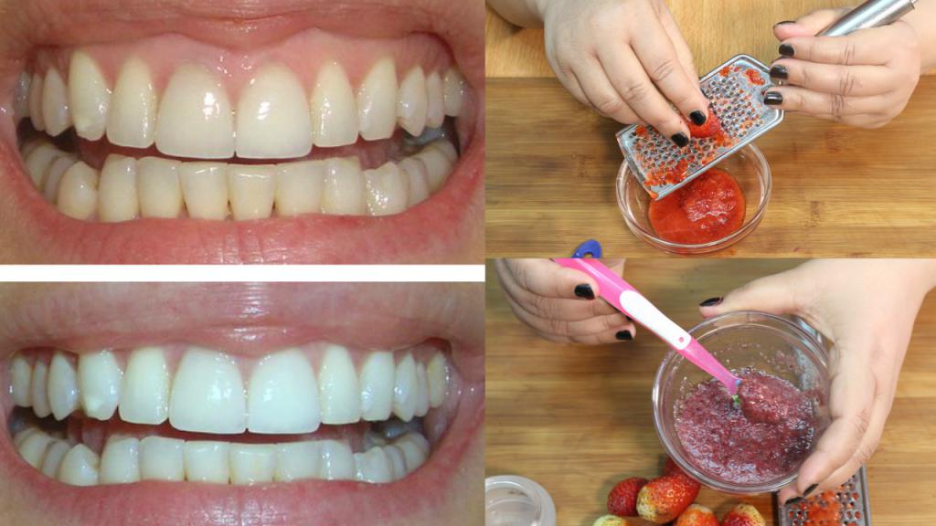 美白牙齿的草莓