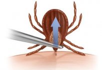 How to remove a tick with yourself?