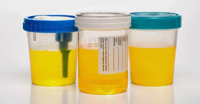 the color of urine when pregnant