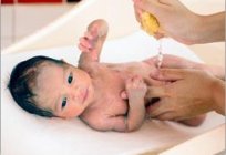 कैसे किया जाता है इलाज के नाभि में एक नवजात शिशु