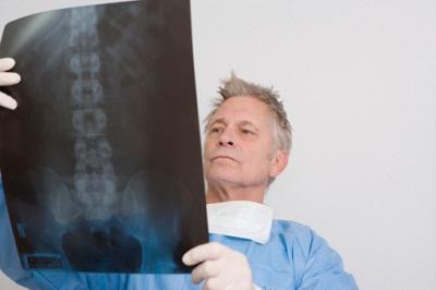trauma of the cervical spine