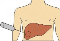审查的肝脏：一个列表的方法