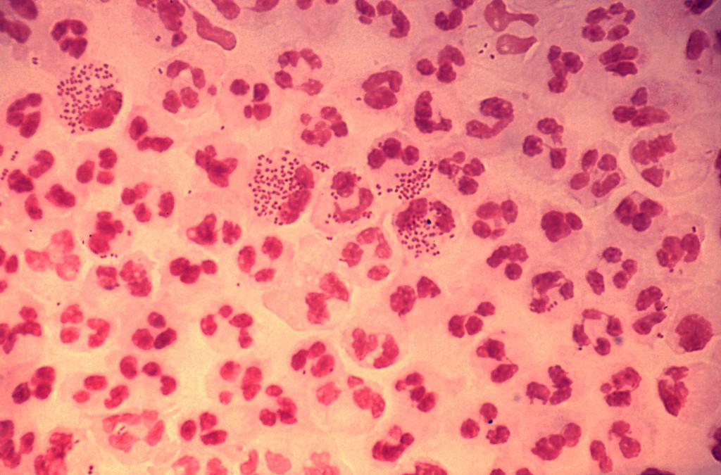 Gonococcus we krwi