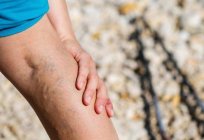 Schmerzen in den Beinen: mögliche Ursachen, Möglichkeiten und die Besonderheiten der Behandlung
