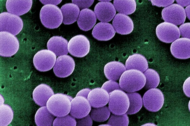Staphylococcus aureus गले के उपचार में वयस्कों