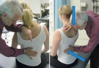 Is it possible to get rid of the syndrome of the vertebral artery?