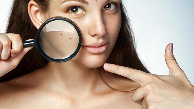 triderm ointment reviews acne