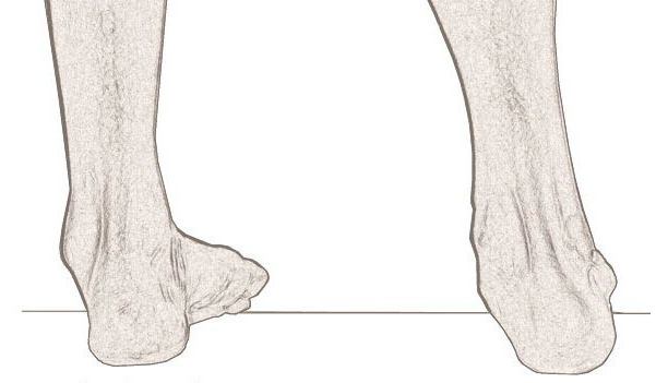 el movimiento de pronación y супинация pies
