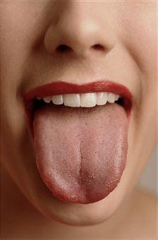 white tongue symptom