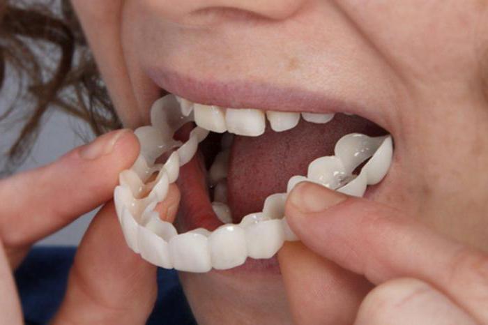 的假牙ACRI免费的缺点