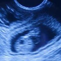 in what period an ultrasound shows pregnancy