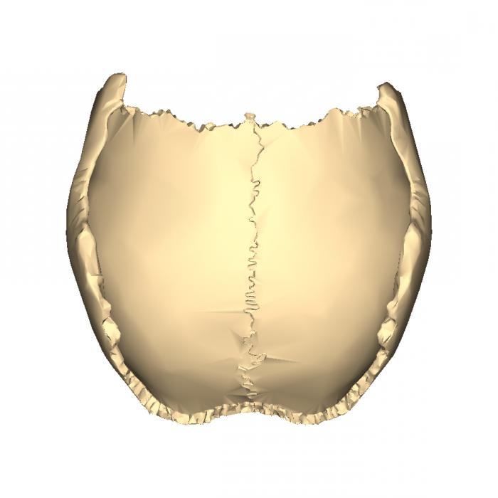 frontal and parietal bone