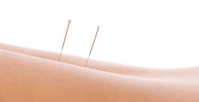 acupuncture points on the human body