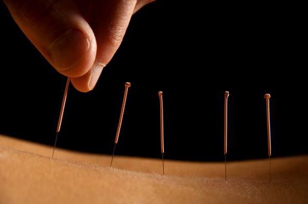 acupuncture benefits and harms