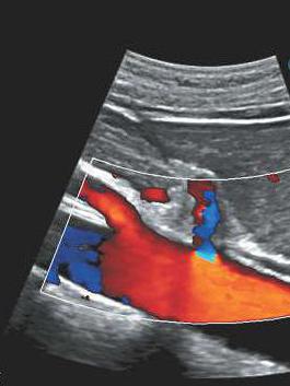 ultrasound diagnostics SPb