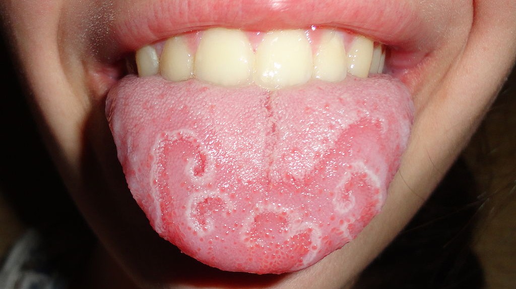الفم في الأطفال