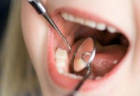 Does it hurt to treat caries without anesthesia?