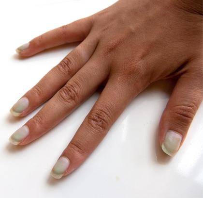 cómo blanquear las uñas