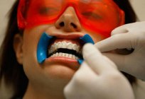 El procedimiento de blanqueamiento de dientes: los clientes y la recomendación
