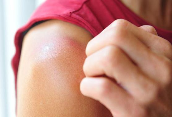 itchy Skin: the symptoms