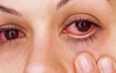 iridine आंख बूंदों के उपयोग के निर्देश