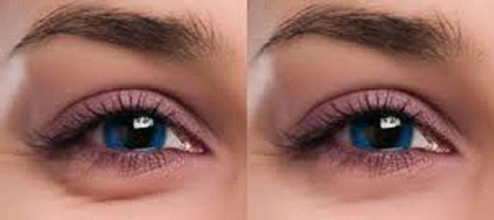 how to remove dark circles under the eyes in “Photoshop”