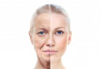 تهتز مدلك الوجه Revoskin الذهب: ردود الفعل السلبية, تعليمات استخدام الوصف