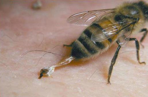 алергія на укус бджоли