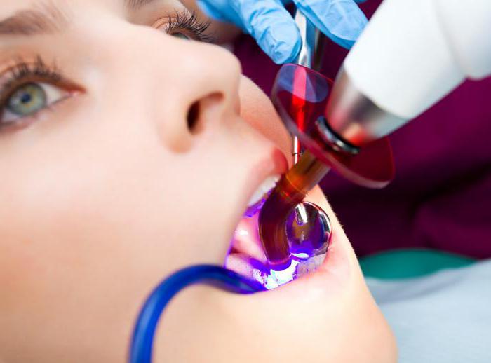 दीपक polymerization दंत चिकित्सा