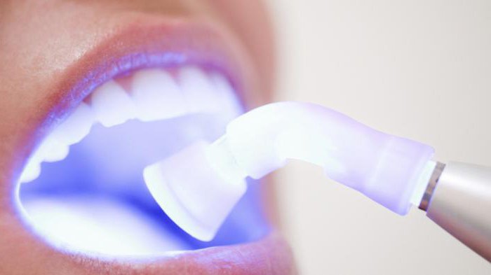 المحاسبة مصباح علاج الأسنان