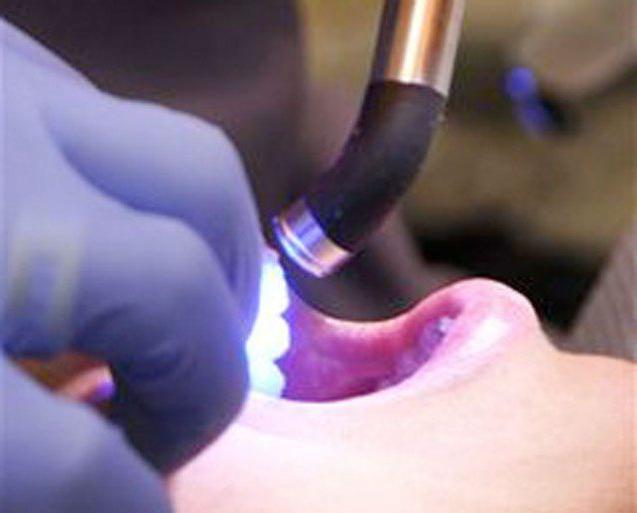 select lamba полимеризационную стоматологческую çin