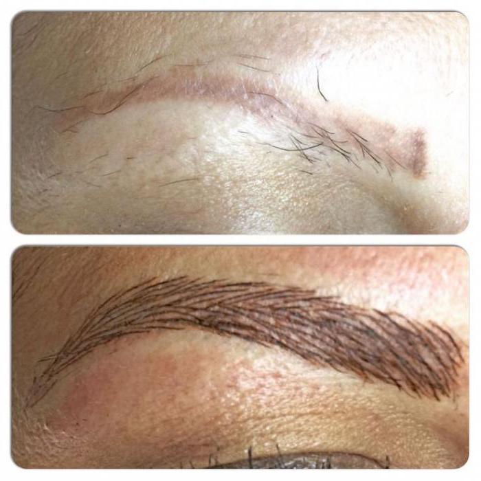 what is the difference permanent eyebrows tatui from microbleeding