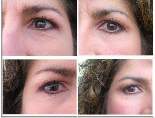 serum around the eyes with hyaluronic acid