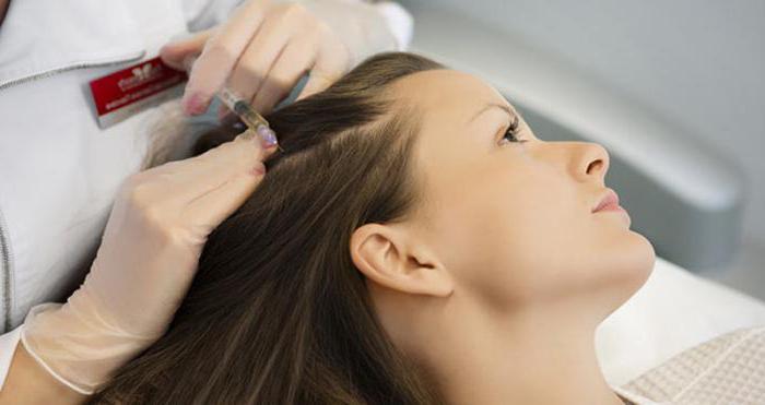 Injektion Mesotherapie der Kopfhaut