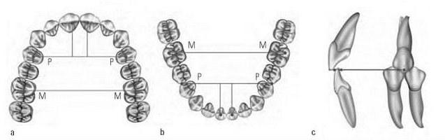 تحديد المركزي نسبة من فك بلا أسنان