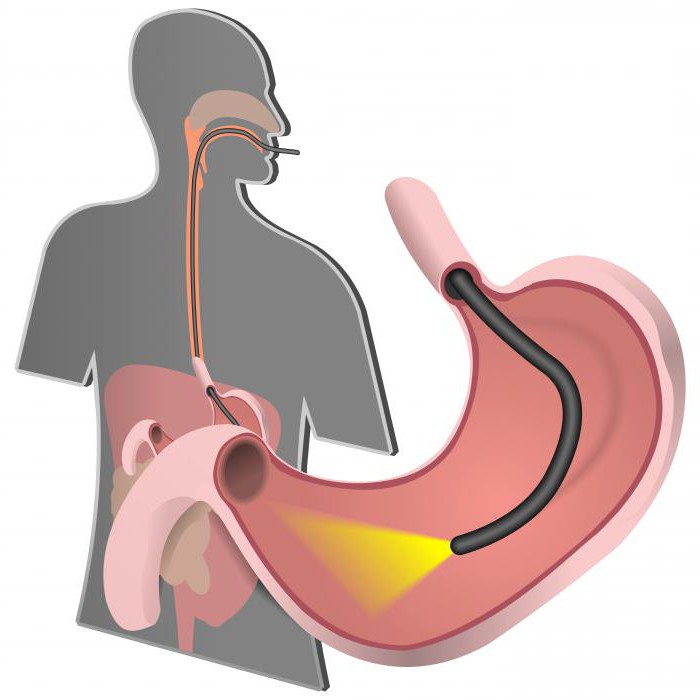 субатрофический zapalenie błony śluzowej żołądka leczenie
