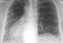 A construção de pulmão humano