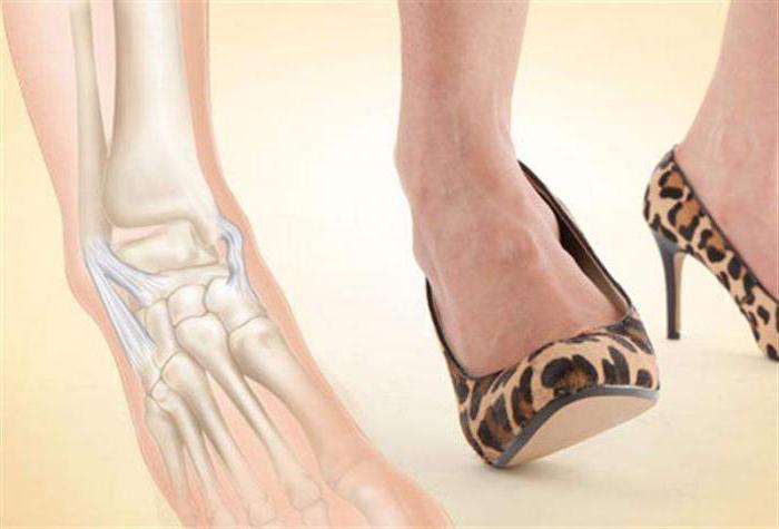 the structure of the ankle joint