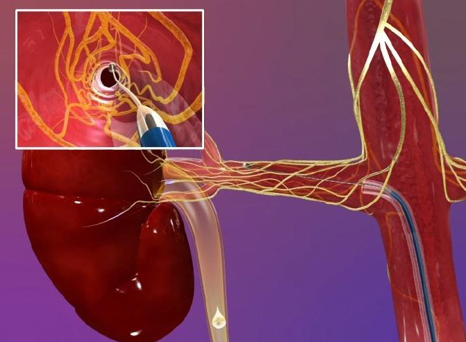 el flujo sanguíneo a los riñones