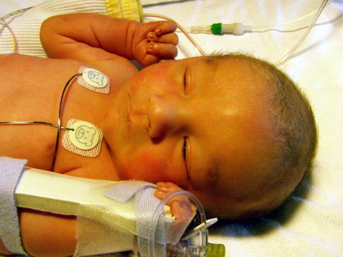 желтушка en el recién nacido, la norma de la bilirrubina tabla
