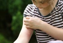 What relieve itching from the bite of mosquitoes in adults and children? Good advice