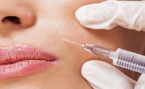 lip Contouring with hyaluronic acid
